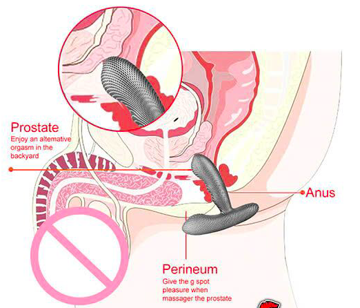 Dụng cụ kích thích hậu môn Levett sợi carbon massage khoái cảm nam gay Dụng cụ kích thích hậu môn Levett sợi carbon massage khoái cảm nam gay